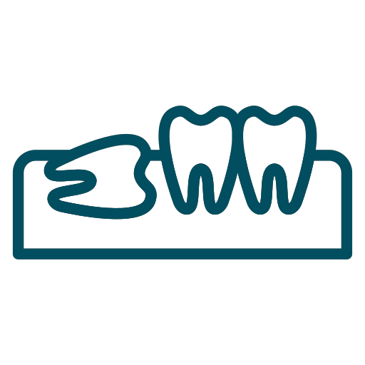 Wisdom Tooth Extraction