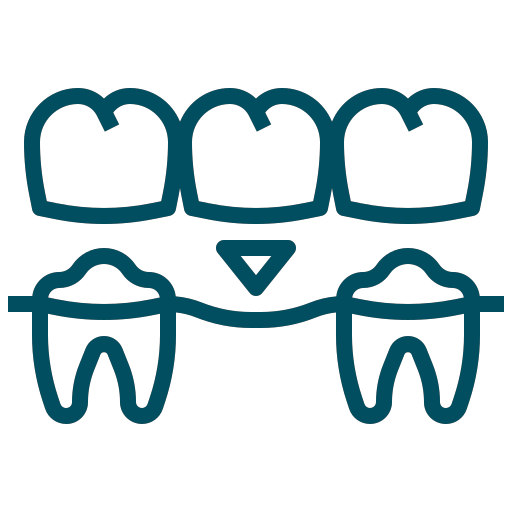 Crowns/Dental Bridges