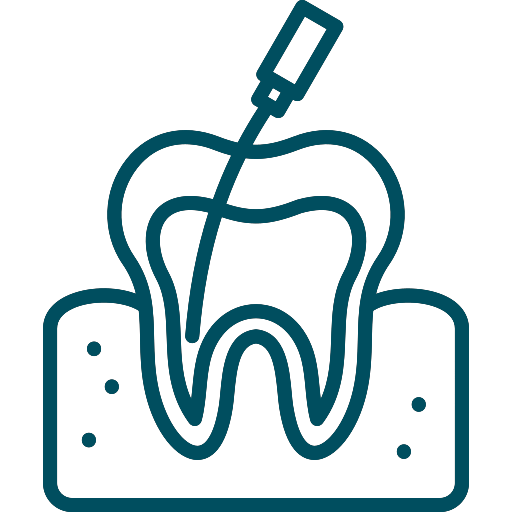 Root canal treatment (Endodontics)